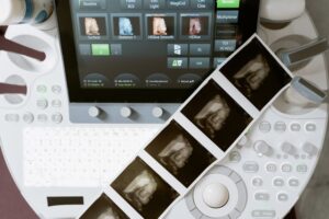 3D medical implants