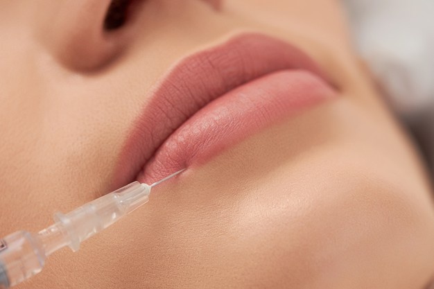 Lip Filling through injection